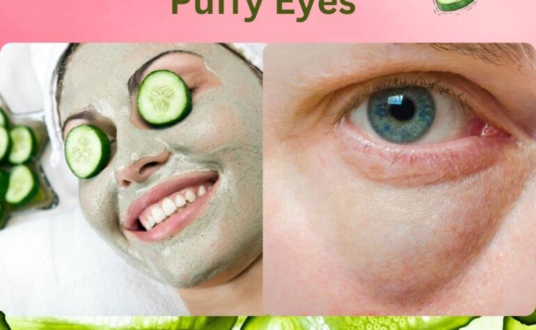 The Refreshing Remedy: Cucumber Slices for Puffy Eyes