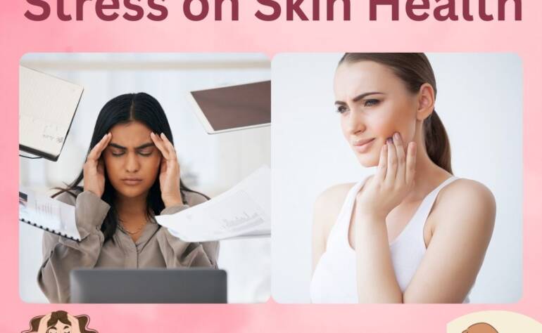 The Affect of Push on Skin Wellbeing: Understanding the Connection